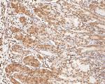 ONECUT3 Antibody in Immunohistochemistry (Paraffin) (IHC (P))