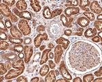 AP2A2 Antibody in Immunohistochemistry (Paraffin) (IHC (P))