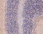 AP2A2 Antibody in Immunohistochemistry (Paraffin) (IHC (P))