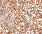 Myogenin Antibody in Immunohistochemistry (Paraffin) (IHC (P))