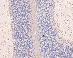 DACT1 Antibody in Immunohistochemistry (Paraffin) (IHC (P))