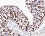 HMGB2 Antibody in Immunohistochemistry (Paraffin) (IHC (P))