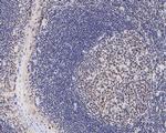 HMGB2 Antibody in Immunohistochemistry (Paraffin) (IHC (P))