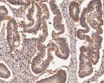 HMGB2 Antibody in Immunohistochemistry (Paraffin) (IHC (P))