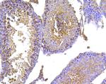 HSPA9 Antibody in Immunohistochemistry (Paraffin) (IHC (P))