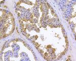 HSPA9 Antibody in Immunohistochemistry (Paraffin) (IHC (P))