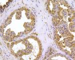 HSPA9 Antibody in Immunohistochemistry (Paraffin) (IHC (P))