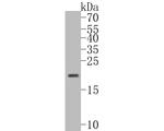 RNASE3 Antibody in Western Blot (WB)