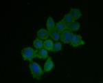 IFNAR1 Antibody in Immunocytochemistry (ICC/IF)