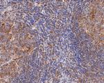 PLCG2 Antibody in Immunohistochemistry (Paraffin) (IHC (P))