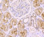 Ferritin Antibody in Immunohistochemistry (Paraffin) (IHC (P))