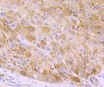 Ferritin Antibody in Immunohistochemistry (Paraffin) (IHC (P))