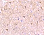 PKM2 Antibody in Immunohistochemistry (Paraffin) (IHC (P))