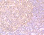 PKM2 Antibody in Immunohistochemistry (Paraffin) (IHC (P))