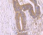 PKM2 Antibody in Immunohistochemistry (Paraffin) (IHC (P))