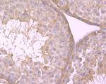 PKM2 Antibody in Immunohistochemistry (Paraffin) (IHC (P))