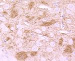 NF-H Antibody in Immunohistochemistry (Paraffin) (IHC (P))