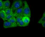 ALDH1A1 Antibody in Immunocytochemistry (ICC/IF)