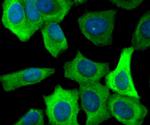 FASN Antibody in Immunocytochemistry (ICC/IF)