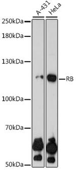 Rb Antibody in Western Blot (WB)