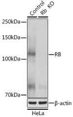 Rb Antibody in Western Blot (WB)