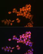 Thioredoxin 1 Antibody in Immunocytochemistry (ICC/IF)