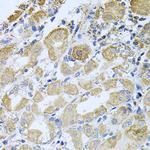 Bcr Antibody in Immunohistochemistry (Paraffin) (IHC (P))