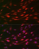 BAK Antibody in Immunocytochemistry (ICC/IF)