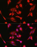 BAK Antibody in Immunocytochemistry (ICC/IF)