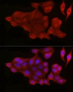 BAX Antibody in Immunocytochemistry (ICC/IF)