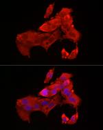 BAX Antibody in Immunocytochemistry (ICC/IF)