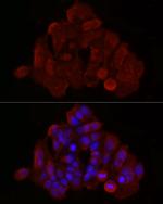 BAX Antibody in Immunocytochemistry (ICC/IF)