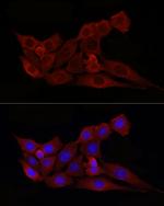 BAX Antibody in Immunocytochemistry (ICC/IF)