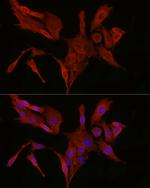 BAX Antibody in Immunocytochemistry (ICC/IF)