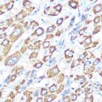 BCL-XL Antibody in Immunohistochemistry (Paraffin) (IHC (P))