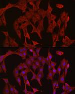 Caspase 3 Antibody in Immunocytochemistry (ICC/IF)