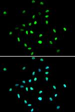 HDAC1 Antibody in Immunocytochemistry (ICC/IF)