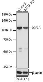 IGF1R (CD221) Antibody in Western Blot (WB)