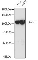 IGF1R (CD221) Antibody in Western Blot (WB)