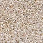 NAMPT Antibody in Immunohistochemistry (Paraffin) (IHC (P))