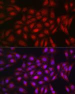 PPAR gamma Antibody in Immunocytochemistry (ICC/IF)