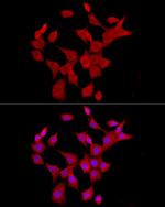 IL-6 Antibody in Immunocytochemistry (ICC/IF)