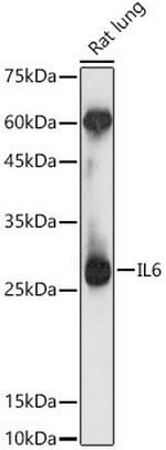 IL-6 Antibody in Western Blot (WB)