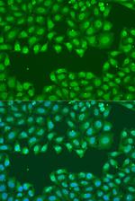 SSB Antibody in Immunocytochemistry (ICC/IF)