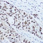 SSB Antibody in Immunohistochemistry (Paraffin) (IHC (P))