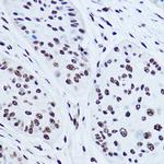 SSB Antibody in Immunohistochemistry (Paraffin) (IHC (P))