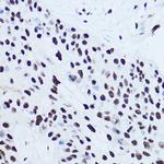 SSB Antibody in Immunohistochemistry (Paraffin) (IHC (P))