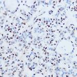 SSB Antibody in Immunohistochemistry (Paraffin) (IHC (P))