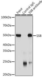 SSB Antibody in Immunoprecipitation (IP)