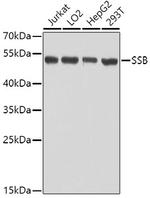 SSB Antibody in Western Blot (WB)